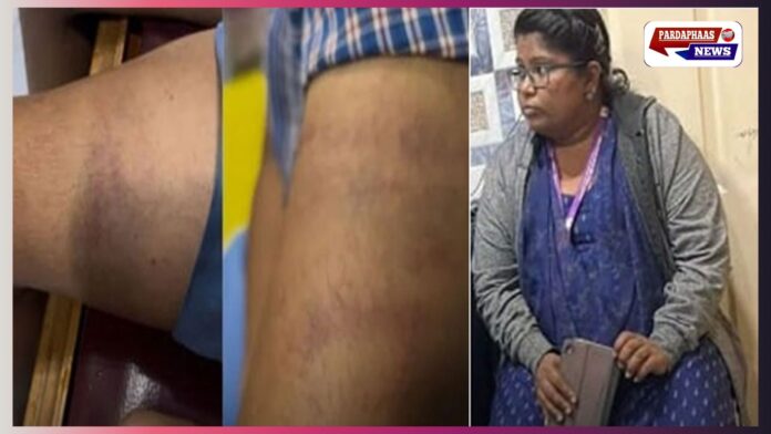 बेंगलुरु में इंसानियत शर्मसार: होमवर्क न करने पर चौथी कक्षा के छात्र की बेरहमी से पिटाई, शिक्षिका पर FIR