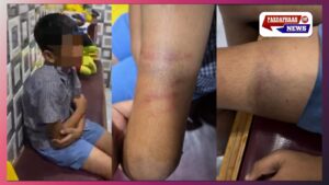 बेंगलुरु में इंसानियत शर्मसार: होमवर्क न करने पर चौथी कक्षा के छात्र की बेरहमी से पिटाई, शिक्षिका पर FIR