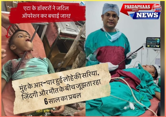 मुंह के आर-पार हुई लोहे की सरिया, जिंदगी और मौत के बीच जूझता रहा 6 साल का प्रबल; एटा के डॉक्टरों ने जटिल ऑपरेशन कर बचाई जान