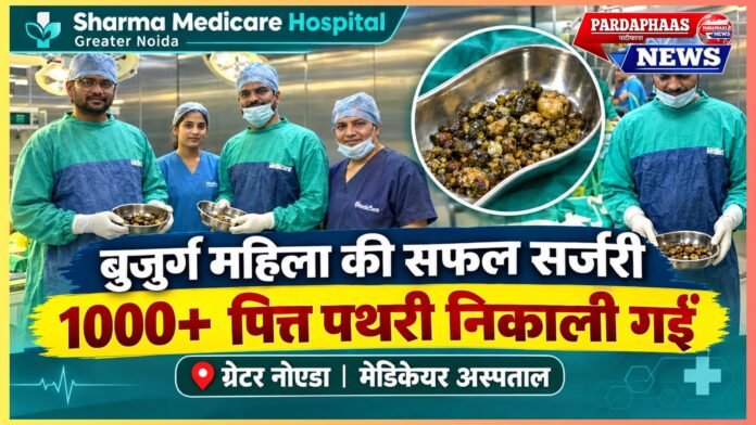 1,000 से ज्यादा पित्त पथरी! ग्रेटर नोएडा के मेडिकेयर अस्पताल में बुजुर्ग महिला की जटिल लैप्रोस्कोपिक सर्जरी
